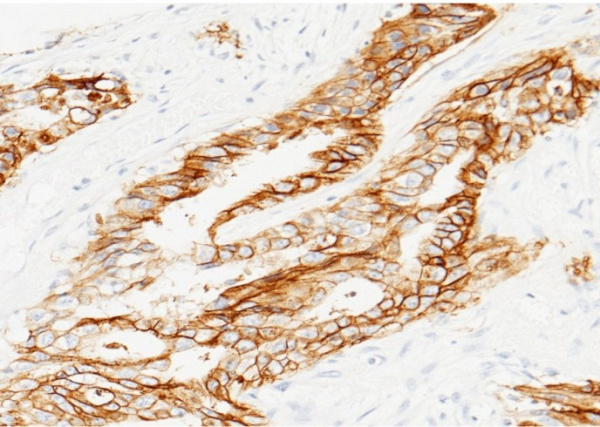 TROP2/TACSTD2 Monoclonal Antibody (AN200176P)
