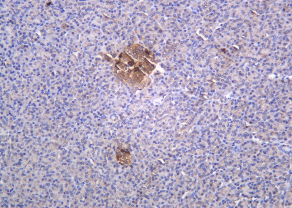 Recombinant Glucagon Monoclonal Antibody (AN301252L)