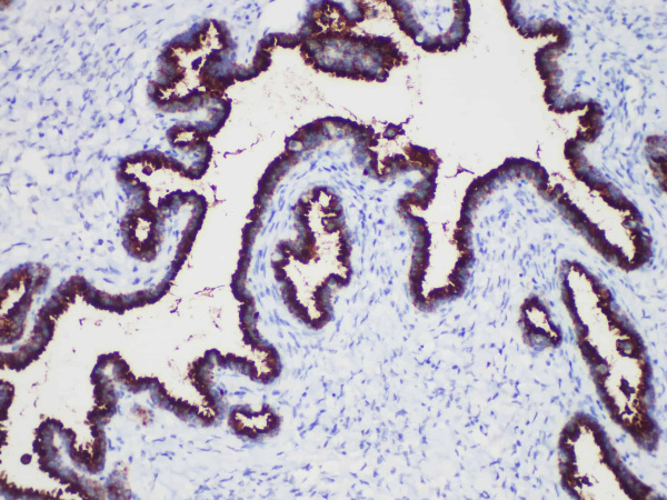 CA-125 Monoclonal Antibody (ELAB6609-M)