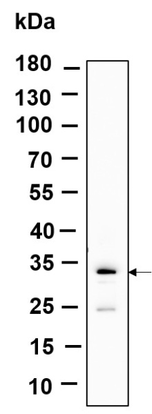 Recombinant SLBP Monoclonal Antibody (AN301237L)
