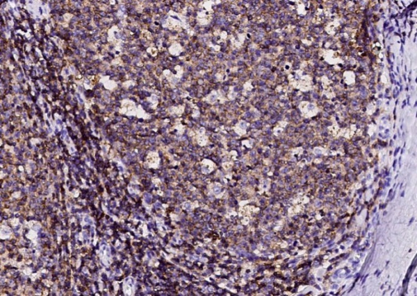 Recombinant Ly108/SLAMF6 Monoclonal Antibody (AN300021P)
