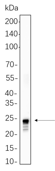 Recombinant Histone H2A (Ubiquityl Lys119) Monoclonal Antibody (AN301326L)