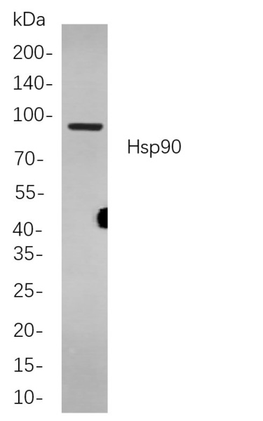 Recombinant Hsp90 Monoclonal Antibody (AN301111L)