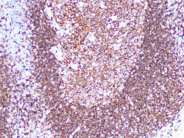 CD19 Monoclonal Antibody (ELAB6718-R)