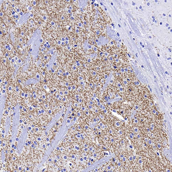 TH Monoclonal Antibody (E-AB-70206)