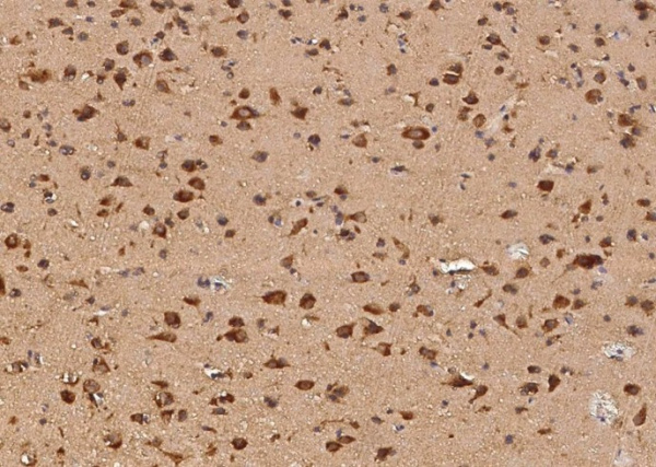 AIMP1/EMAP II Monoclonal Antibody (AN200183P)