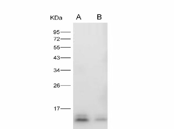 Anti-Zika virus(ZIKV)(strain Zika SPH2015) ZIKV-E/Envelope protein(Domain III) Monoclonal Antibody (E-AB-V1333)