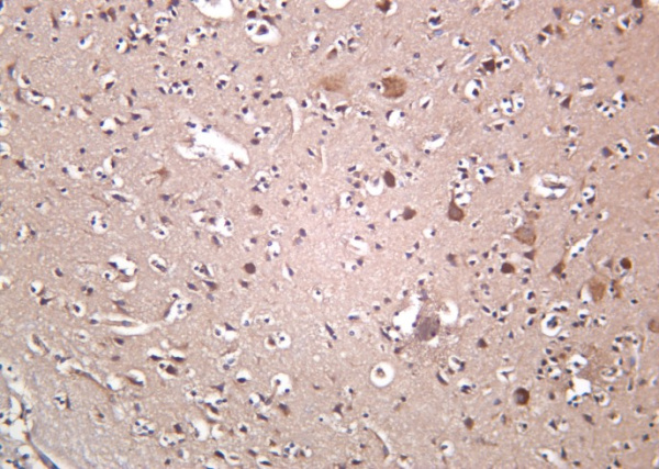 Recombinant OPA1 Monoclonal Antibody (AN301265L)