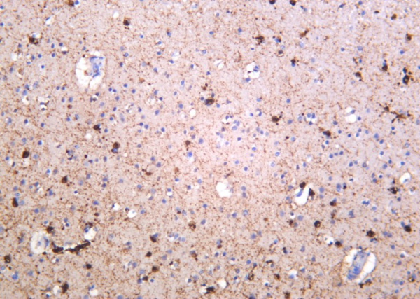 Recombinant NMDAR1 Monoclonal Antibody (AN301289L)