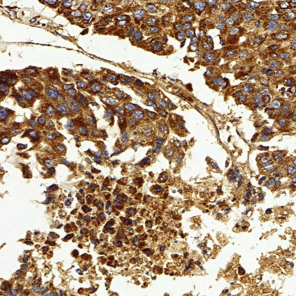 IGF1 Polyclonal Antibody (E-AB-70301)