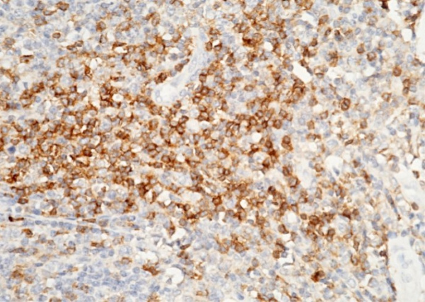Recombinant CD4 Monoclonal Antibody (AN300001P)