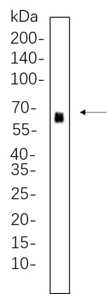 Recombinant Phospho-PDPK1 (Ser241) Monoclonal Antibody (AN301308L)