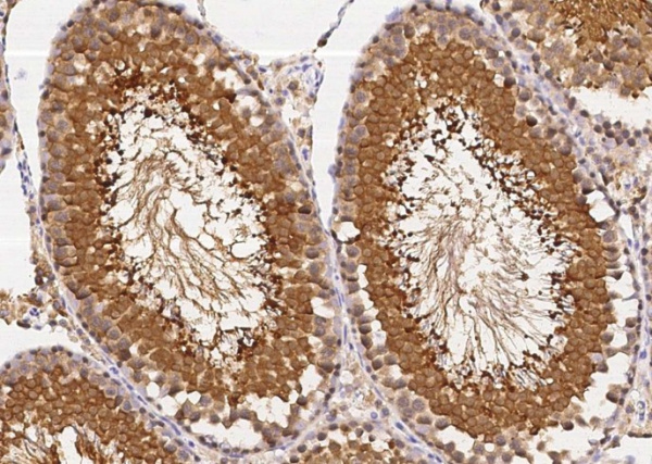 Recombinant UCHL3 Monoclonal Antibody (AN300584P)