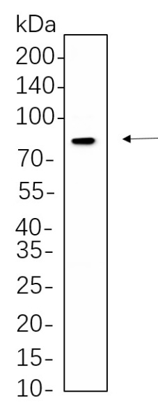 Recombinant Phospho-DRP1 (Ser616) Monoclonal Antibody (AN301321L)