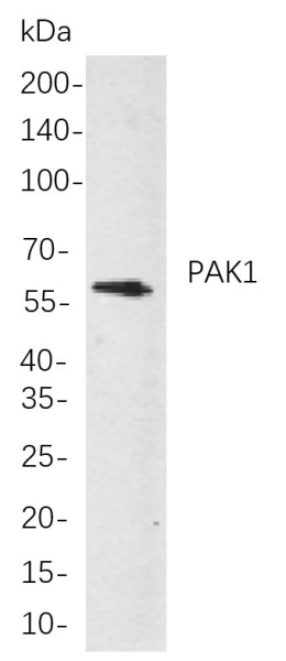Recombinant PAK1 Monoclonal Antibody (AN300910L)
