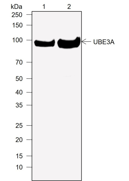 Recombinant UBE3A Monoclonal Antibody (AN302038L)
