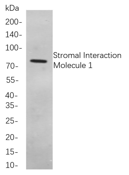 Recombinant Stromal Interaction Molecule 1 Monoclonal Antibody (AN300992L)