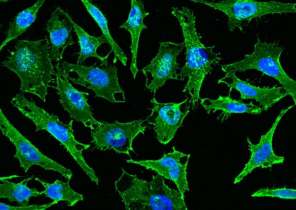 CD44 Antibody Polyclonal Antibody (AN100005P)