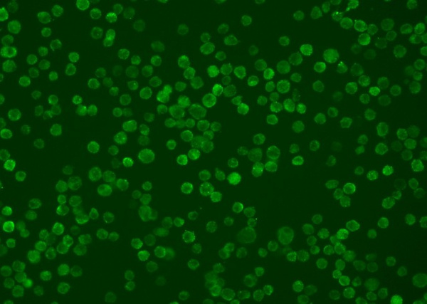 Recombinant HVEM/TNFRSF14/CD270 Monoclonal Antibody (AN300320P)