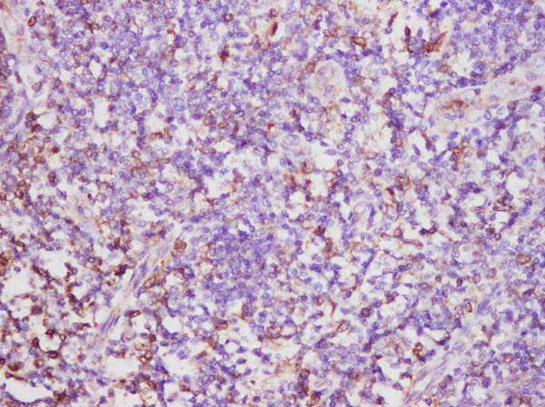 CD74 Polyclonal Antibody (AN006060L)