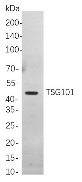 Recombinant TSG101 Monoclonal Antibody (AN301029L)