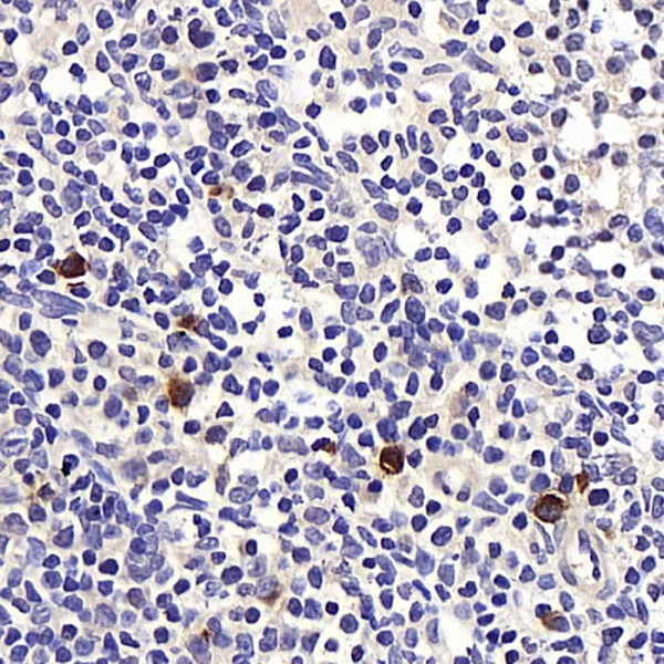 BAG2 Polyclonal Antibody (E-AB-70258)