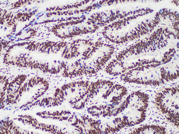 PMS2 Monoclonal Antibody (ELAB6729-M)