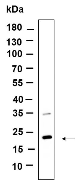 Recombinant CD81 Monoclonal Antibody (AN301119L)