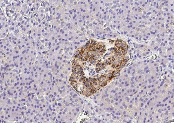 Recombinant Fractalkine/CX3CL1 Monoclonal Antibody (AN300199P)