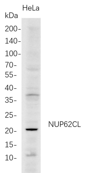Recombinant NUP62CL Monoclonal Antibody (AN300749L)