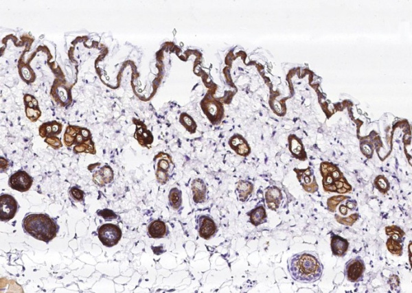 Recombinant TROP-2/TACSTD2 Monoclonal Antibody (AN300565P)