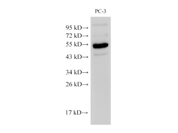 Chromogranin A Polyclonal Antibody (E-AB-40339)