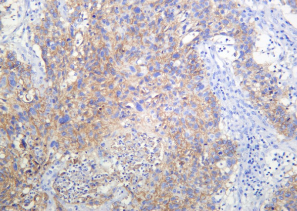 Recombinant RSK3 Monoclonal Antibody (AN301245L)