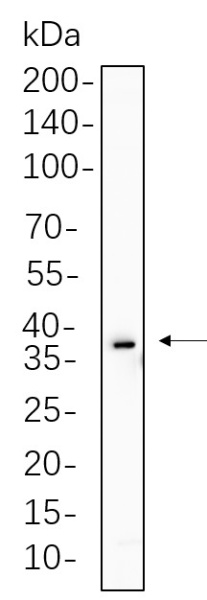 Recombinant SIX2 Monoclonal Antibody (AN301357L)