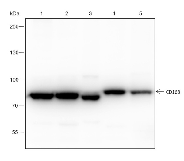 Recombinant CD168 Monoclonal Antibody (AN301465L)