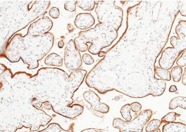 Recombinant LIFR/CD118 Monoclonal Antibody (AN300079P)