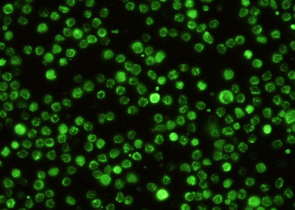Recombinant SIGNR1/CD209b Monoclonal Antibody (AN300523P)