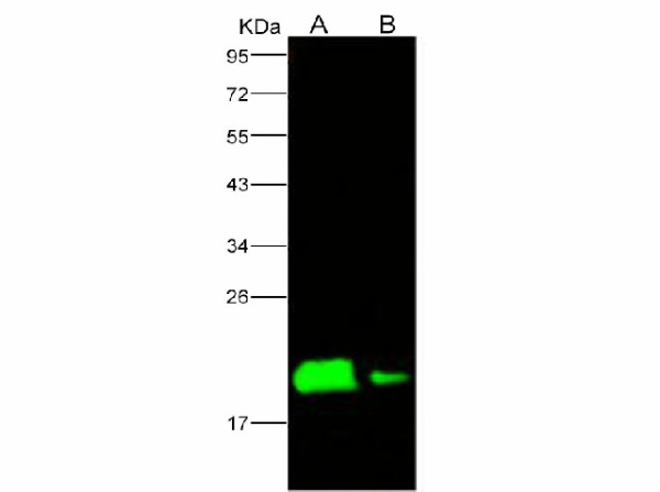 Anti-Ebola virus EBOV(subtype Zaire, strain H.sapiens-wt/GIN/2014/Kissidougou-C15) Nucleoprotein/NP Polyclonal Antibody (E-AB-V1127)