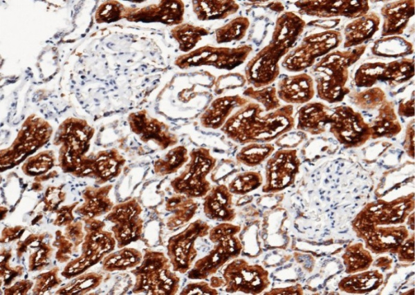 Recombinant XPNPEP2 Monoclonal Antibody (AN300084P)
