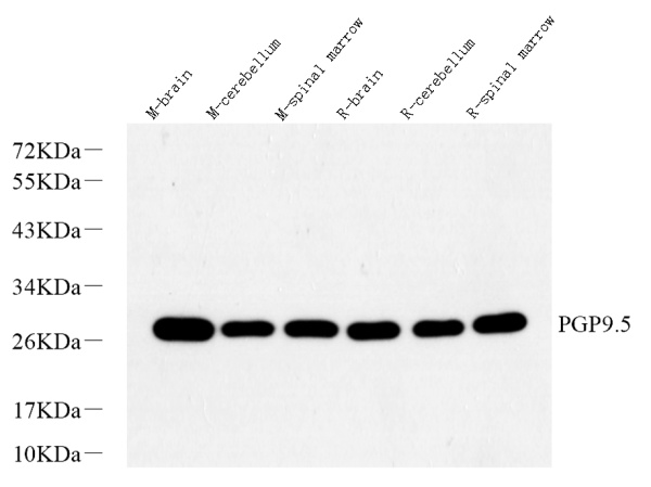 PGP 9.5 Polyclonal Antibody (E-AB-70251)