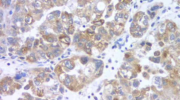 FSHR Polyclonal Antibody (E-AB-70134)