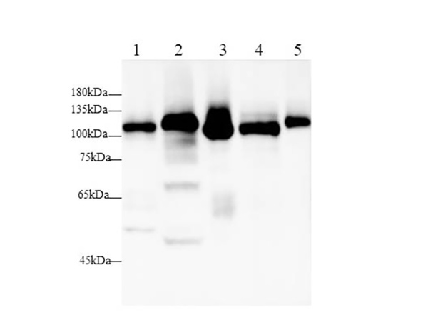 DPP4/CD26 Polyclonal antibody (AN006030L)