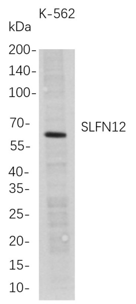 Recombinant SLFN12 Monoclonal Antibody (AN300771L)