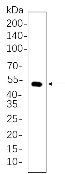 Recombinant Cytokeratin 14 Monoclonal Antibody (AN300733L)
