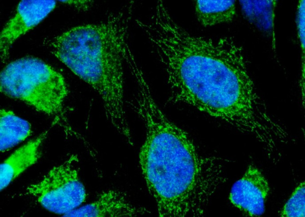 Recombinant Lumican/LUM Monoclonal Antibody (AN300406P)