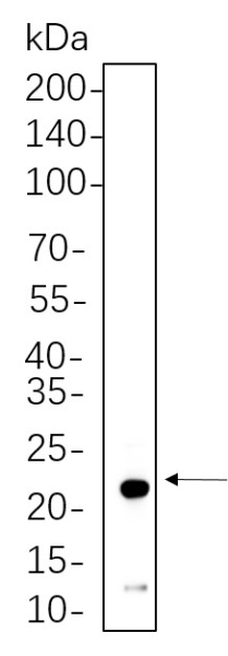 Recombinant NDUFB8 Monoclonal Antibody (AN301375L)