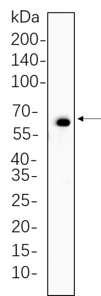 Recombinant Phospho-Paxillin (Tyr118) Monoclonal Antibody (AN300692L)