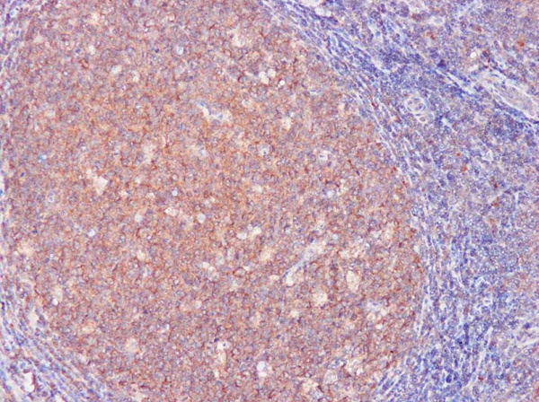 IL-3 Polyclonal Antibody (AN006080L)