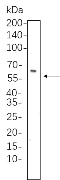 Recombinant Smad4 Monoclonal Antibody (AN300827L)