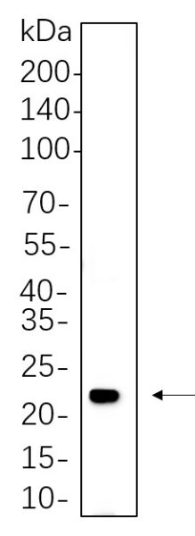 Recombinant HRAS Monoclonal Antibody (AN300826L)